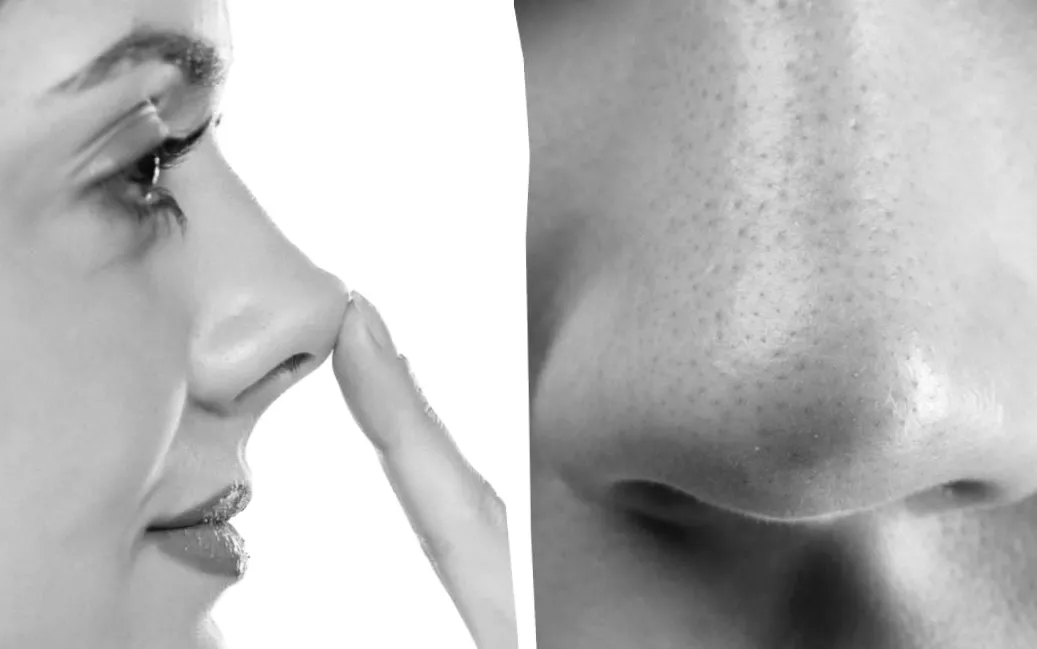 Ніс, що вражає: історія чоловіка з «олівцевим» носом