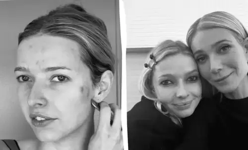 Донька Гвінет Пелтроу розповіла про проблеми зі шкірою: зіркове фото без макіяжу