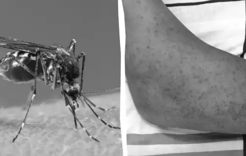 Європу може охопити загадкова тропічна загроза, – The Guardian